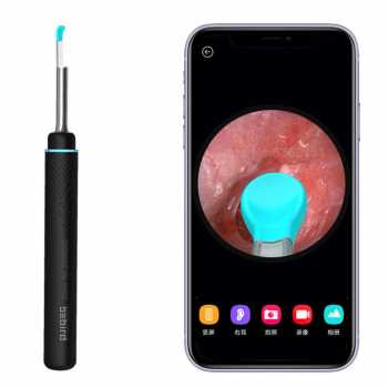 Bebird Kamera Endoskopi Pembersih Telinga Otoskop Wireless Endoscope - M9 Pro - Black