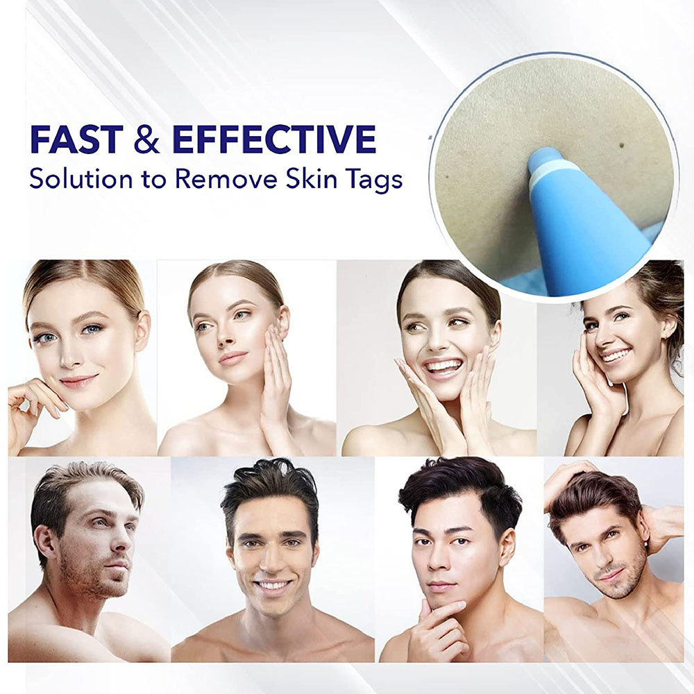 Gambar produk LEKGAVD Alat Penghilang Kutil Painless Skin Tag Mole Removal Kit - LGV40 - 5