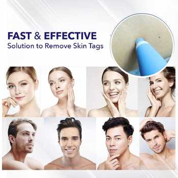 Gambar produk LEKGAVD Alat Penghilang Kutil Painless Skin Tag Mole Removal Kit - LGV40 - 5