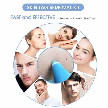Gambar produk LEKGAVD Alat Penghilang Kutil Painless Skin Tag Mole Removal Kit - LGV40 - 2