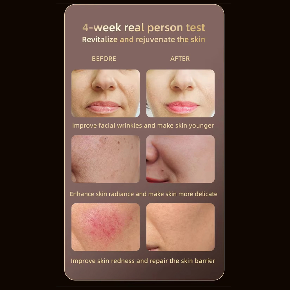 Gambar produk Vilnason Masker LED Facial Mask Photon Therapy 8 Color 2600mAh - SM-2313