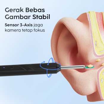 Gambar produk NATFIRE Kamera Endoskopi Pembersih Telinga Otoskop Endoscope HD WiFi - NE18