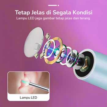 Gambar produk NATFIRE Kamera Endoskopi Pembersih Telinga Otoskop Endoscope HD WiFi - NE18