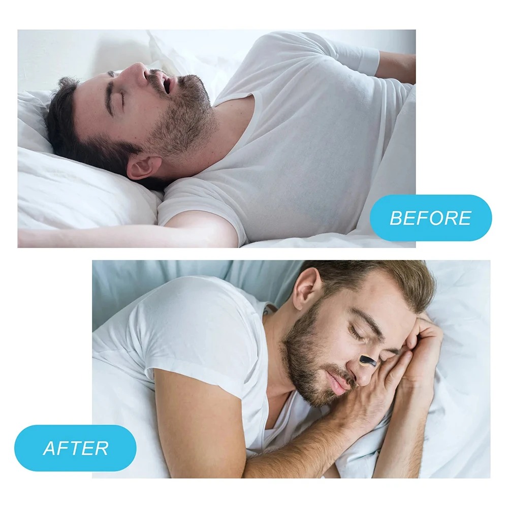 Gambar produk Brease Patch Magnet Nasal Dilator Anti Snoring Waterproof 30 Pair - JK0092