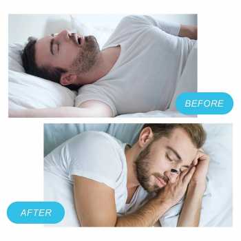 Gambar produk Brease Patch Magnet Nasal Dilator Anti Snoring Waterproof 30 Pair - JK0092