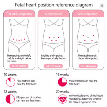 Gambar produk Angelbeats Alat Deteksi Jantung Janin Fetal Doppler Heart Rate Monitor - I200