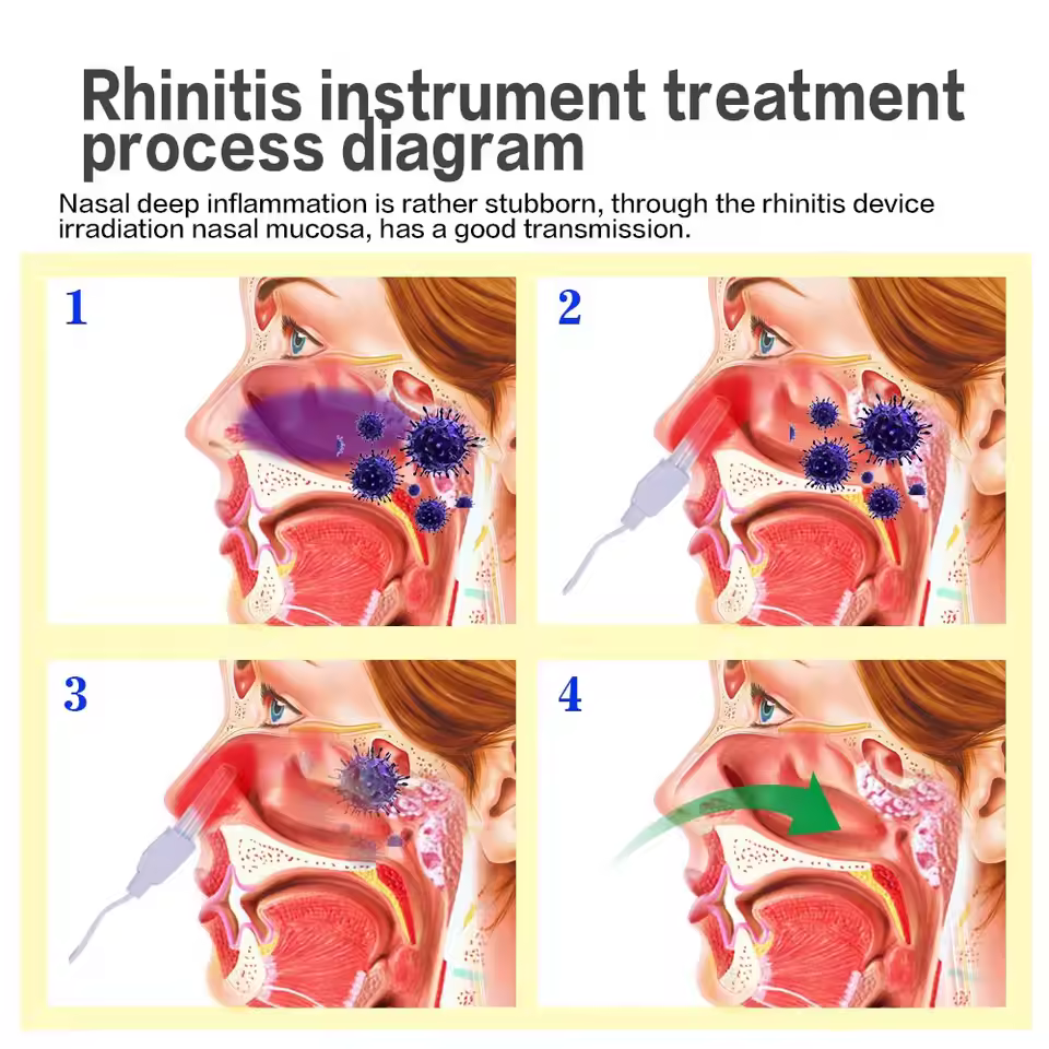 Gambar produk Bionase Pengobatan Sinusitis Hidung Nose Rhinitis Therapy Massage - R-133