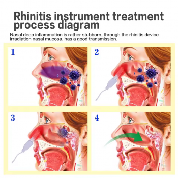 Gambar produk Bionase Pengobatan Sinusitis Hidung Nose Rhinitis Therapy Massage - R-133