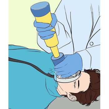 Gambar produk HYE Perangkat Penyelamat Pencegah Tersedak Choking Rescue Emergency - H-22