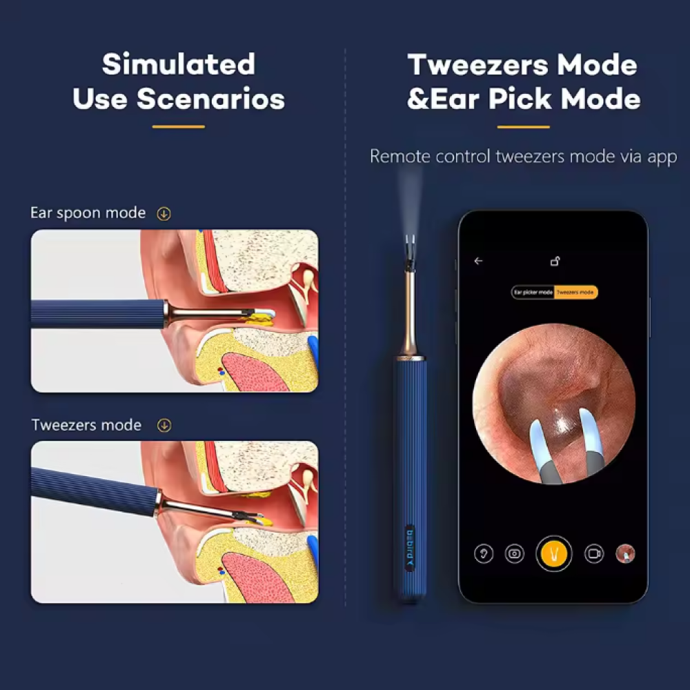Gambar produk Bebird Kamera Endoskopi Pembersih Telinga Endoscope HD WiFi - Note 3 Pro