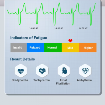 Gambar produk TMJD Alat Pengukur Detak Jantung EKG Wireless ECG Portable - ER1