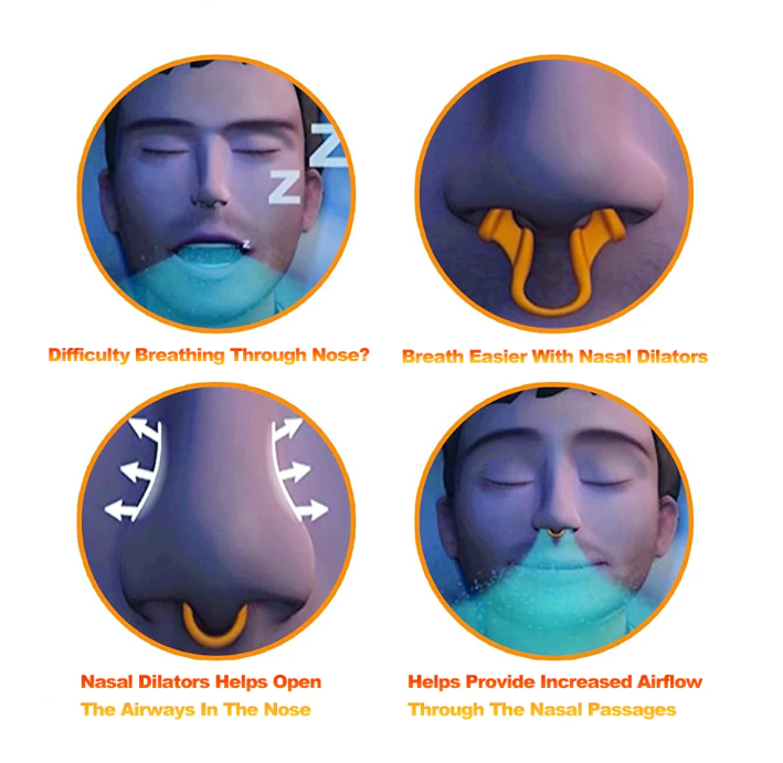 Gambar produk Sleepease Nasal Dilator Anti Snoring Arrester Sleep Silicone 1 PCS - SL1