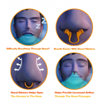 Gambar produk Sleepease Nasal Dilator Anti Snoring Arrester Sleep Silicone 1 PCS - SL1