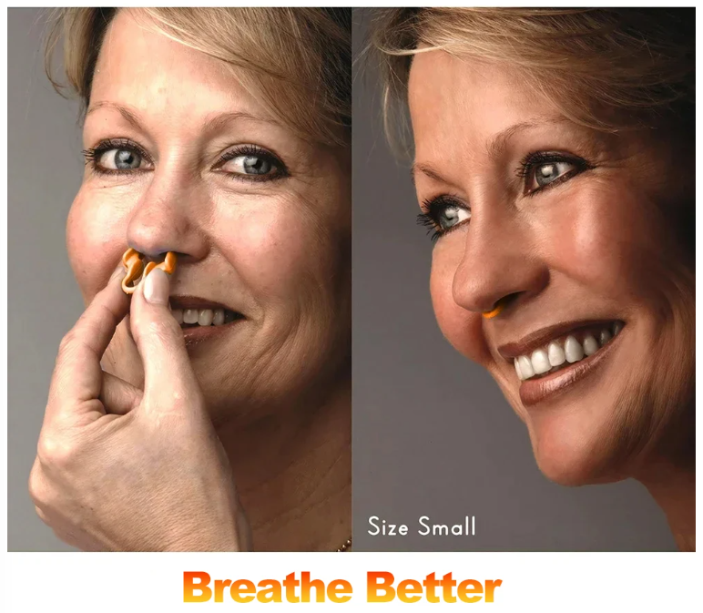 Gambar produk Sleepease Nasal Dilator Anti Snoring Arrester Sleep Silicone 1 PCS - SL1