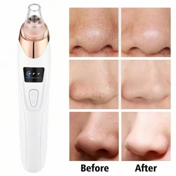 Gambar produk AGO Alat Hisap Komedo Elektrik Facial Pore Vacuum with 5 Suction Heads - GA5