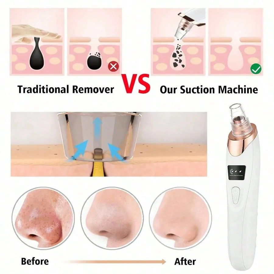 Gambar produk AGO Alat Hisap Komedo Elektrik Facial Pore Vacuum with 5 Suction Heads - GA5