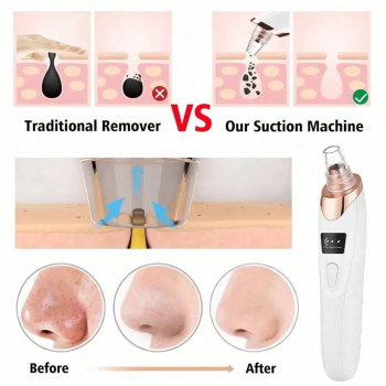 Gambar produk AGO Alat Hisap Komedo Elektrik Facial Pore Vacuum with 5 Suction Heads - GA5