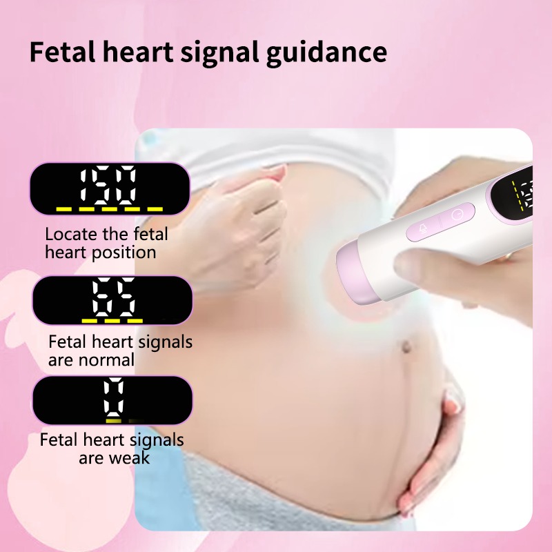 Mafabe Alat Deteksi Jantung Janin Fetal Doppler Heartrate Handheld - TX-103 Gambar produk Mafabe Alat Deteksi Jantung Janin Fetal Doppler Heartrate Handheld - TX-103