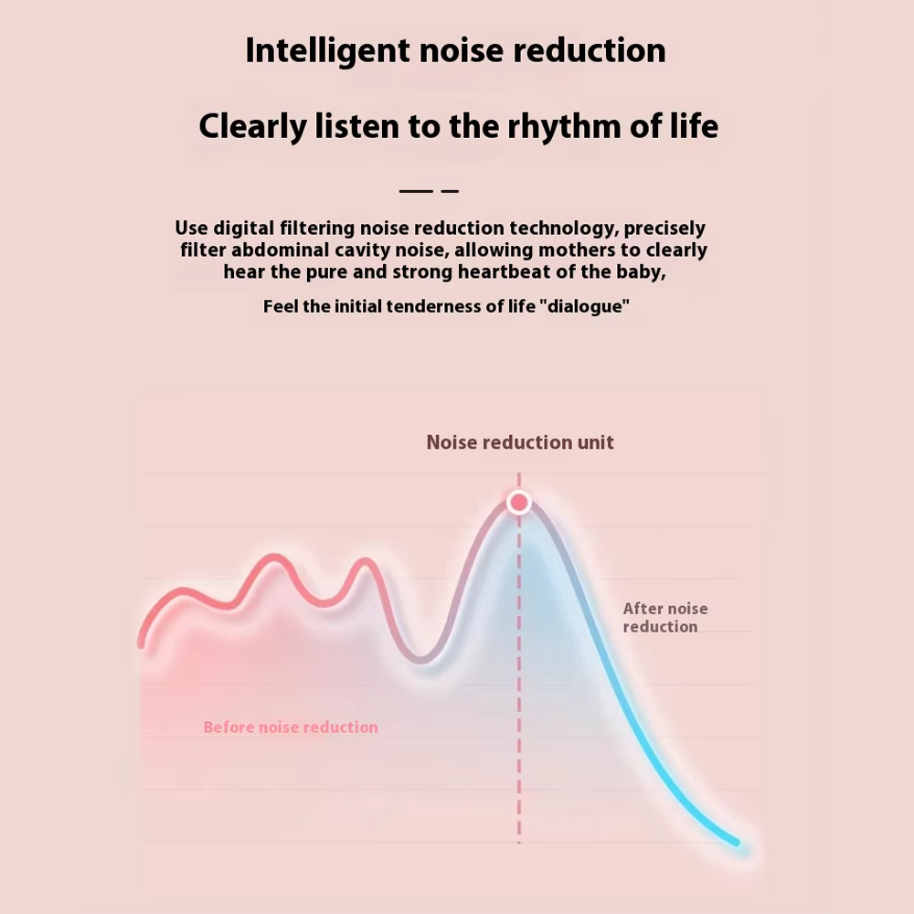Villego Alat Deteksi Jantung Janin Fetal Doppler Heartrate 2.5MHz - KWL-101 Gambar produk Villego Alat Deteksi Jantung Janin Fetal Doppler Heartrate 2.5MHz - KWL-101