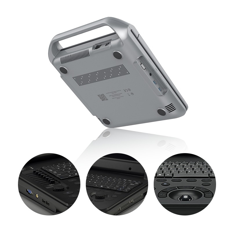 TaffOmicron USG Digital 2D Portable Ultrasound Scanner 12 Inch 4B Mode - PU-DL121A Gambar produk TaffOmicron USG Digital 2D Portable Ultrasound Scanner 12 Inch 4B Mode - PU-DL121A