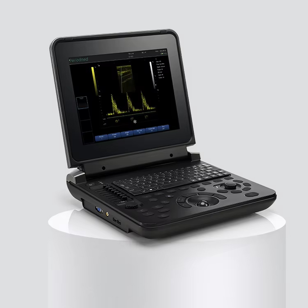 TaffOmicron USG Digital 2D Portable Ultrasound Scanner 12 Inch 4B Mode - PU-DL121A Gambar produk TaffOmicron USG Digital 2D Portable Ultrasound Scanner 12 Inch 4B Mode - PU-DL121A