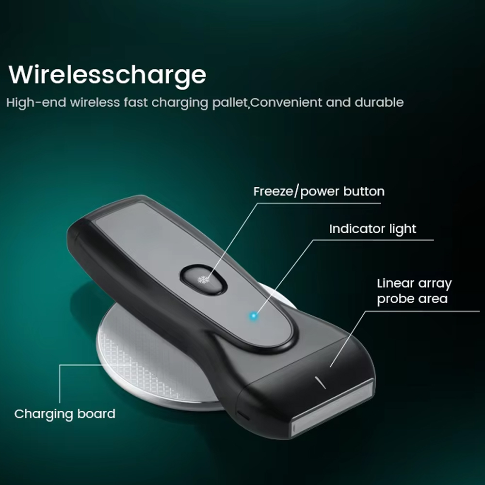 TaffOmicron USG Probe 2D Handheld Ultrasound Bluetooth Triplex Mode - PEU1A Gambar produk TaffOmicron USG Probe 2D Handheld Ultrasound Bluetooth Triplex Mode - PEU1A