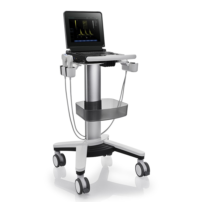 TaffOmicron USG Digital 2D Portable Ultrasound Scanner 12 Inch 4B Mode - PU-DL121A Gambar produk TaffOmicron USG Digital 2D Portable Ultrasound Scanner 12 Inch 4B Mode - PU-DL121A