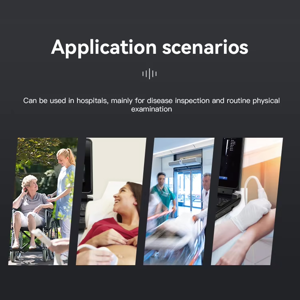 TaffOmicron USG Digital 2D Portable Ultrasound Scanner 12 Inch 4B Mode - PU-DL121A Gambar produk TaffOmicron USG Digital 2D Portable Ultrasound Scanner 12 Inch 4B Mode - PU-DL121A