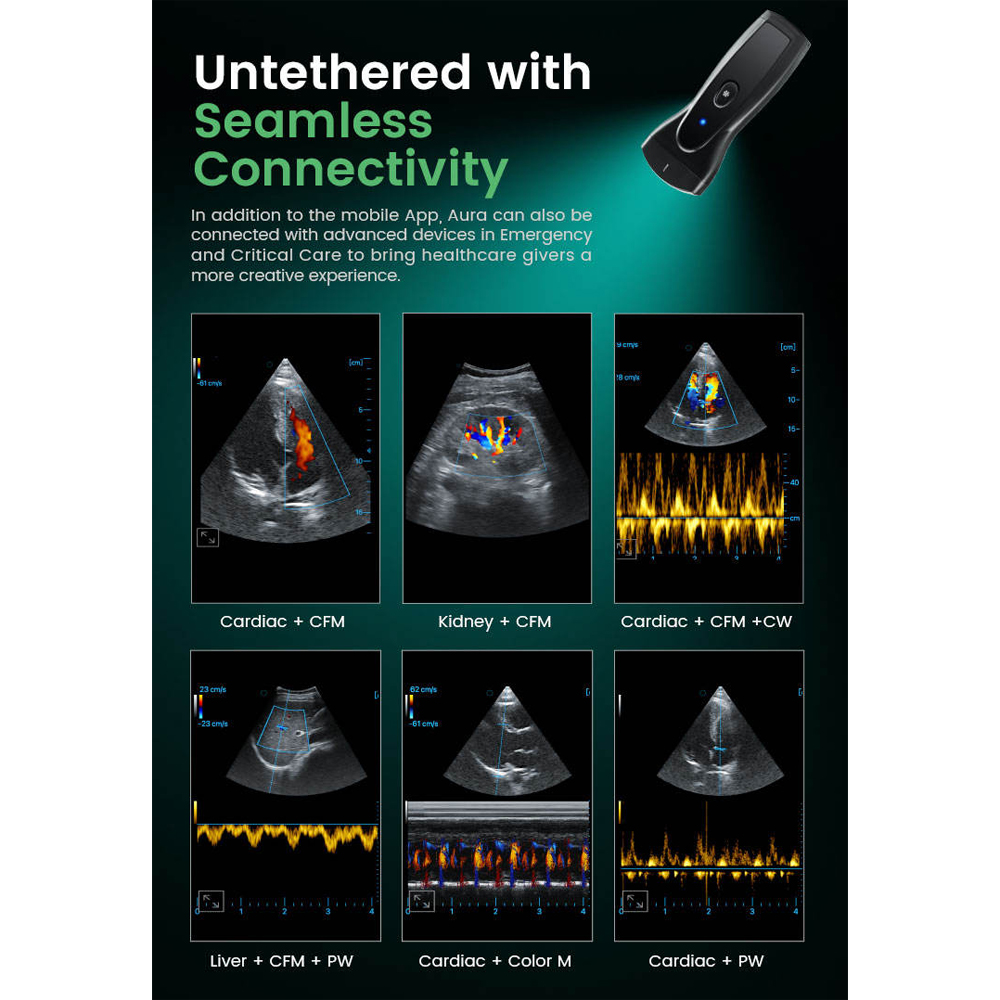 TaffOmicron USG Probe 2D Handheld Ultrasound Bluetooth Triplex Mode - PEU1B Gambar produk TaffOmicron USG Probe 2D Handheld Ultrasound Bluetooth Triplex Mode - PEU1B