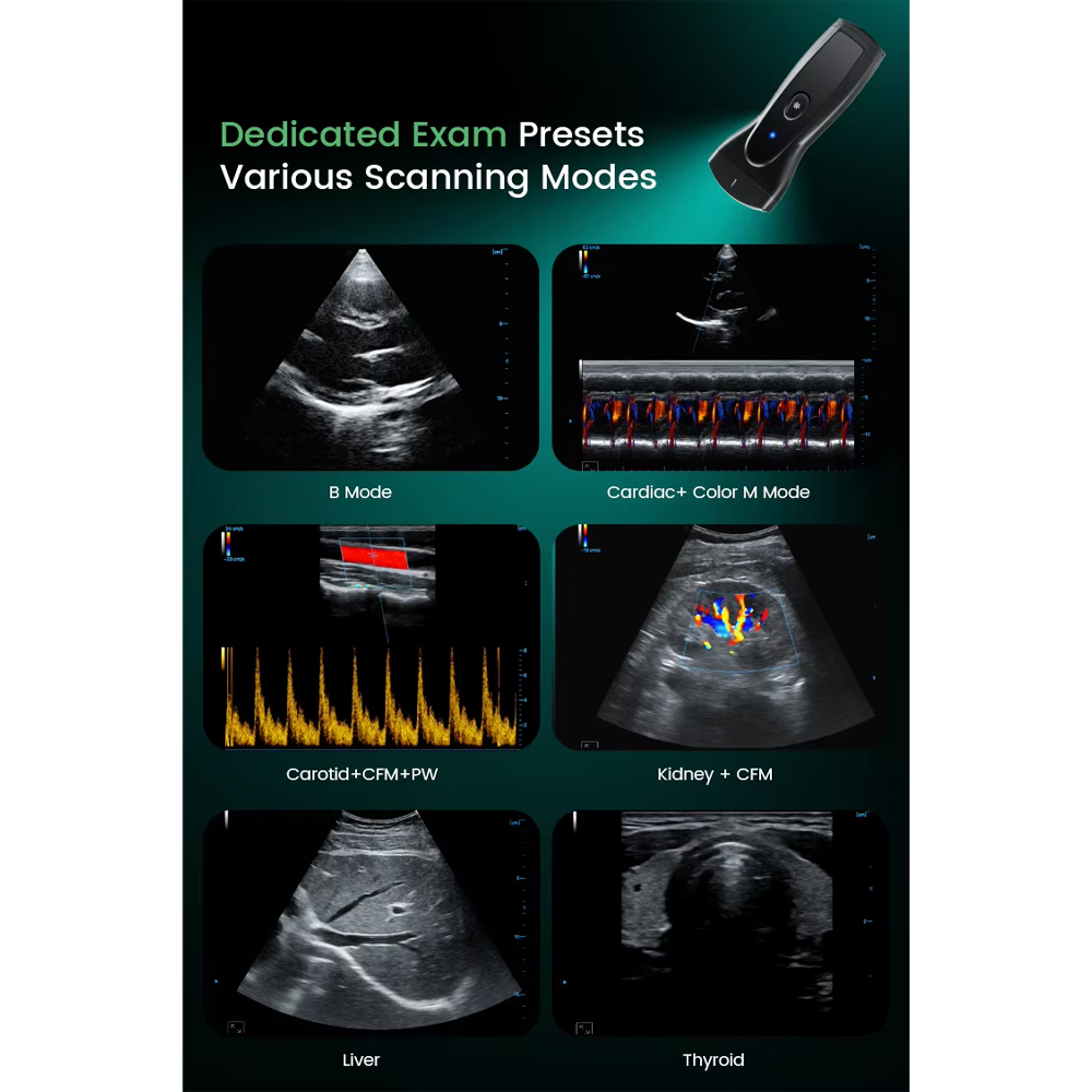 TaffOmicron USG Probe 2D Handheld Ultrasound Bluetooth Triplex Mode - PEU1B Gambar produk TaffOmicron USG Probe 2D Handheld Ultrasound Bluetooth Triplex Mode - PEU1B