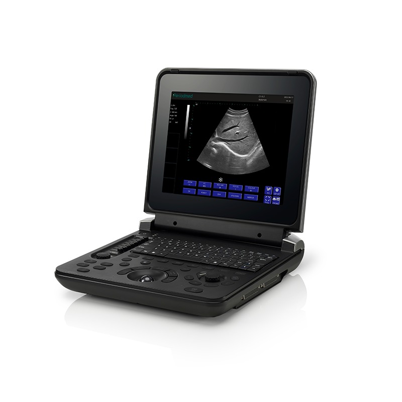 TaffOmicron USG Digital 2D Portable Ultrasound Scanner 12 Inch 4B Mode - PU-DL121A Gambar produk TaffOmicron USG Digital 2D Portable Ultrasound Scanner 12 Inch 4B Mode - PU-DL121A
