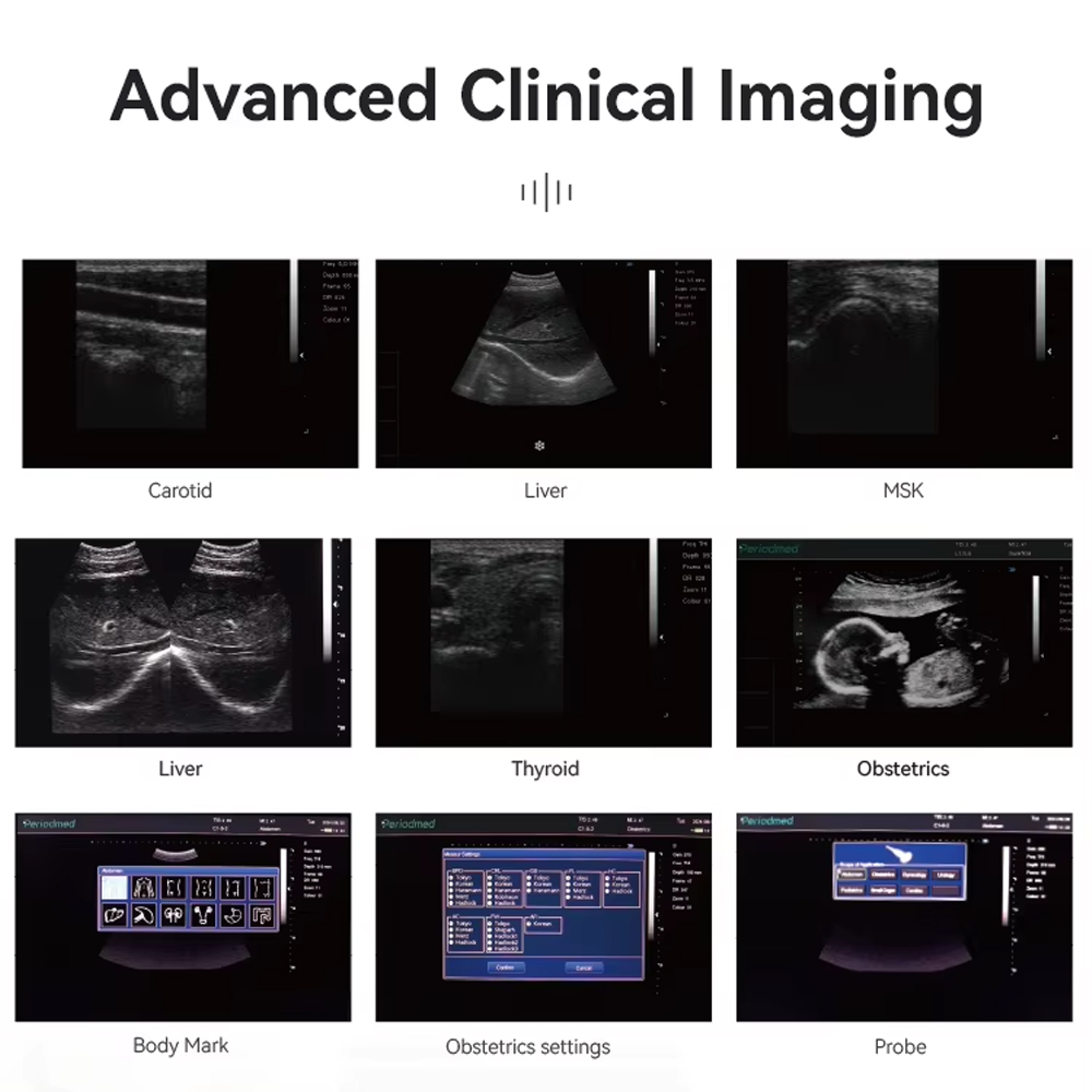 TaffOmicron USG Digital 2D Portable Ultrasound Scanner 12 Inch 4B Mode - PU-DL121A Gambar produk TaffOmicron USG Digital 2D Portable Ultrasound Scanner 12 Inch 4B Mode - PU-DL121A