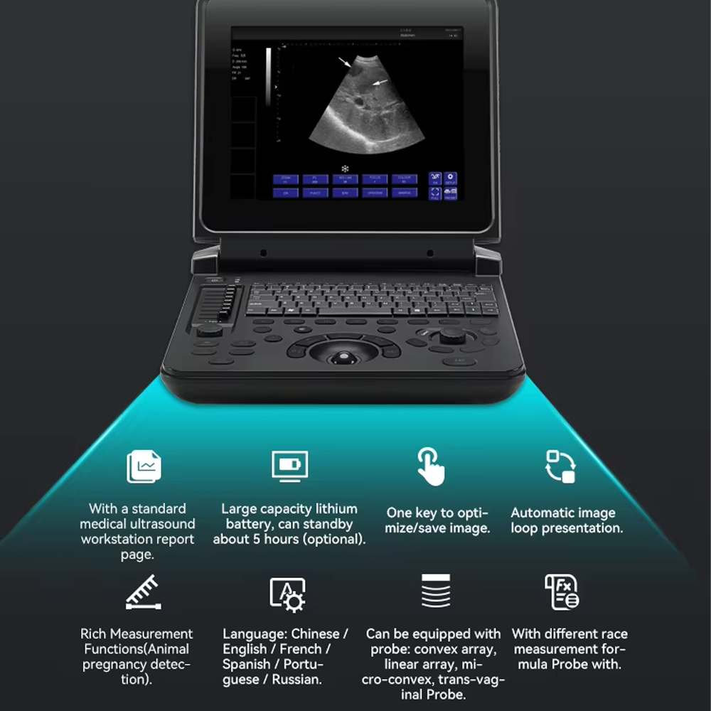 TaffOmicron USG Digital 2D Portable Ultrasound Scanner 12 Inch 4B Mode - PU-DL121A Gambar produk TaffOmicron USG Digital 2D Portable Ultrasound Scanner 12 Inch 4B Mode - PU-DL121A