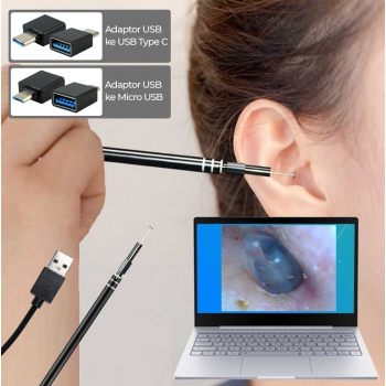 Gambar produk TaffOmicron Kamera Endoskopi Pembersih Telinga HD Endoscope USB - EU-0