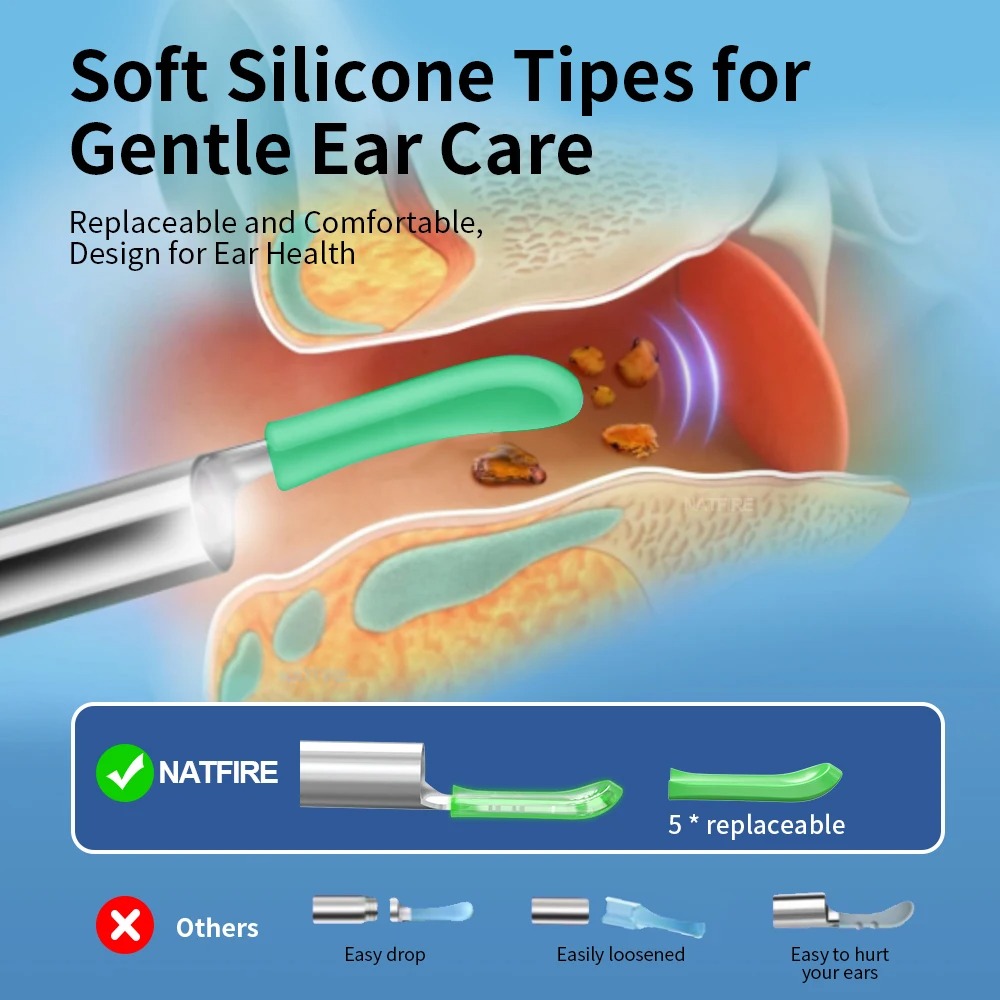 NATFIRE Kamera Pembersih Telinga Korek Kuping Otoskop Endoscope 3MP - NE3-E Gambar produk NATFIRE Kamera Pembersih Telinga Korek Kuping Otoskop Endoscope 3MP - NE3-E - 3