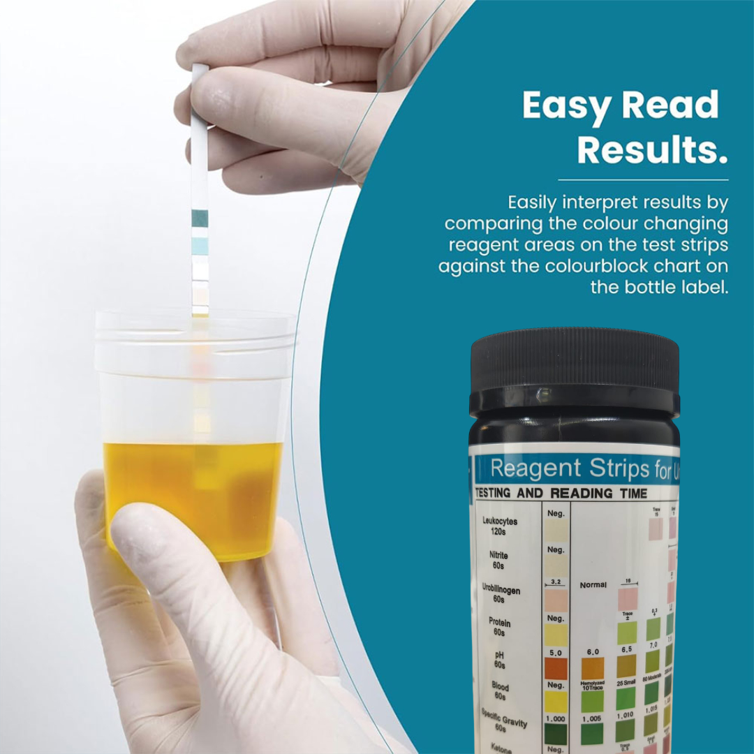 FRC Test Strip Urine Urinalysis 10 Parameter Cek Keto Gula 100 PCS - URS-10T Gambar produk FRC Test Strip Urine Urinalysis 10 Parameter Cek Keto Gula 100 PCS - URS-10T - 4