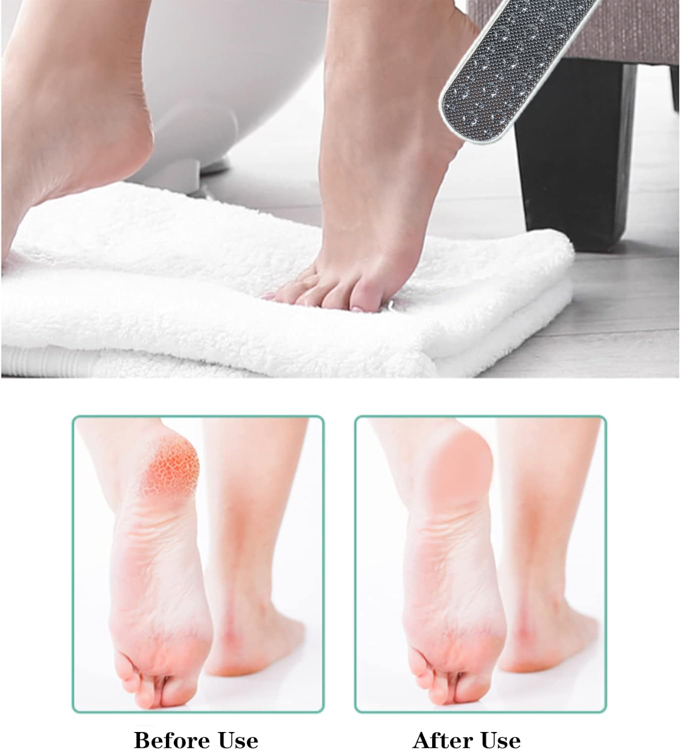 Gambar produk Merssavo Alat Perawatan Kaki Pedicure Foot Care Scrubber 1 PCS - HB07 - 4